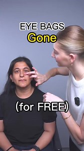 Eye bags gone #eyebags #undereyebags #undereyes #facefitness #facemassage #faceyoga | Elvin Dick