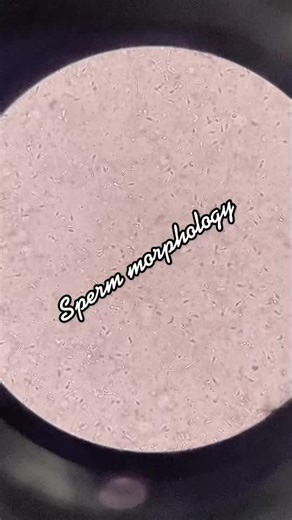 Exploring Sperm Morphology Under the Microscope