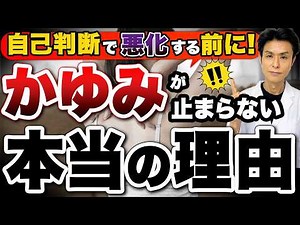 止まらないかゆみ…薬が効かないかゆみの正体！皮膚科医が教える原因6選と対策