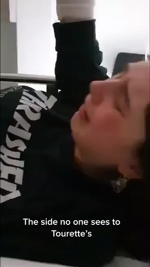 TRIGGER WARNING- more raw footage of tic attacks that need hospital intervention #tics #ticsawareness #tourettes #tourettesawareness #fyp #foryoupage #ticattck #hospitallife