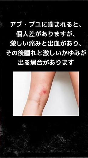 夏の大敵！アブ、ブヨ対策 3選