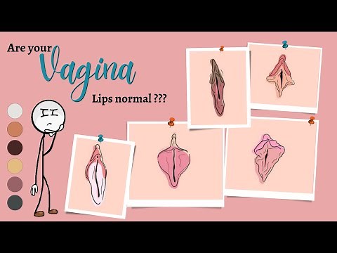 Are your vaginal lips normal | know your BODY