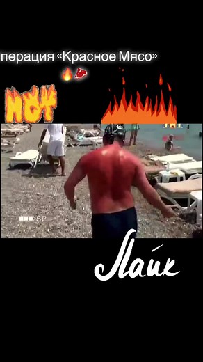 Операция Красное Мясо: Летние Приколы и Загар