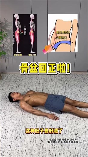 Fix Pelvic Anteversion: 5-Minute Bedtime Ritual for Perfect Posture