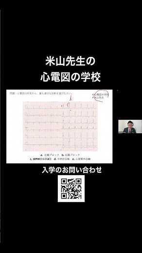 【心電図検定】右脚ブロックを徹底解説✨ #shorts