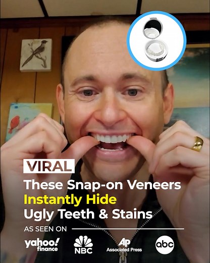 🛑 Over 100,000 people are hiding their real smile behind Shiny Smile Veneers and no one can tell they're removable Stop avoiding photos. Stop covering your mouth. Stop missing moments because you're self-conscious about your teeth. Shiny Smile Veneers cover gaps, stains & missing teeth with a custom fit from real dental impressions—no drills, no pain, no $20,000 dental bill. ✅ Eat, talk, and smile naturally ✅ Looks and feels completely real ✅ Takes weeks, not months Your confident smile is wait