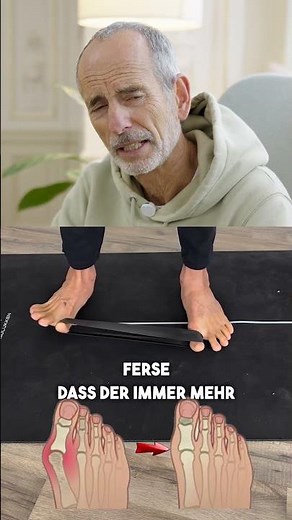 Übungen können vielleicht gegen Schmerzen helfen, aber doch nicht gegen den Hallux valgus selbst?