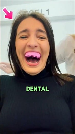 When Dental Impression Goes WRONG! 😱