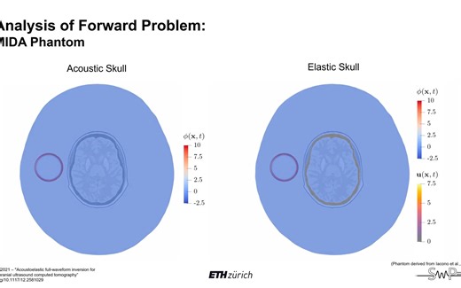 全波形反演FWI用于经颅超声Full-Waveform Inversion for Transcranial Ultrasound