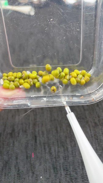 #dentalcleaning #tartarremover#cleanteeth #teethcleaning #teethtok