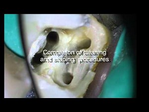 Zespół zmian endo-perio - rozważania kliniczne • Film • MEDtube.pl