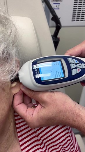 This patient came in with concerns about a hole in the eardrum after a previous repair. Initial examinations were misleading, but using a tympanometer revealed more about the condition. Watch to learn! #CompassioMedical #DrJeffLaCour #ENT #HealthyLiving #Medicine #Tymapnometry #Tympanogram