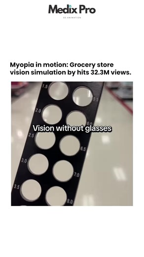 This video shows what everyday life is like for someone with myopia (short-sightedness) when trying to navigate a store without glasses or contact lenses. Starting from clear vision (0.00) and gradually increasing to -12.00, it shows how the world becomes more blurred at each prescription level. Myopia is one of the most common vision conditions worldwide, and this video helps viewers understand the real-life challenges millions of people face daily when they don't have corrective lenses.#fyp #v