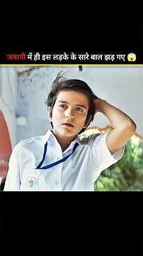 Bala Movie Explained In Hindi Dubbed #shorts #movie #explained