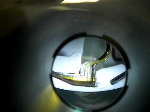 Spectra optia Apheresis interface in progress