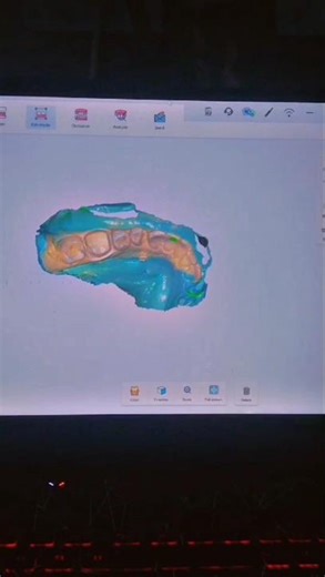 🔥 Teeth Cutting 3D Model | Step-by-Step with File 🦷💥