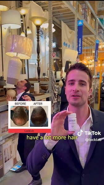 Locklab: The Effective Solution for Men's Hair Loss