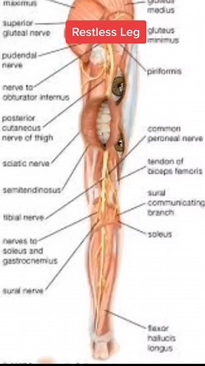 Understanding Restless Leg Syndrome: Tips and Remedies
