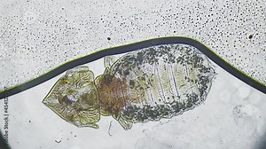 Head lice under the microscope. Skin flea under magnification. Animal disease in the veterinary laboratory. The insect in the hair of the body drinks the blood. Beetles in animals. Transparent cell.