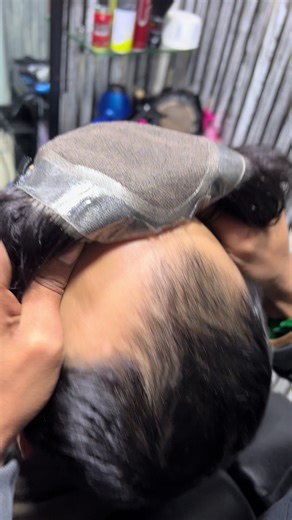 Discover the Best Hair Patch Solutions at Capital Hair Club