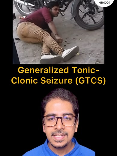 Understanding Generalized Tonic-Clonic Seizure Management