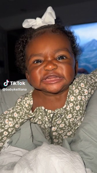Understanding Kaliana's Gummy Smile and Water Baby Doll Baby