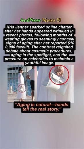 Kris Jenner’s Hands Spark Buzz After $100K Facelift Reveal #krisjenner #kyliejenner #news #shorts