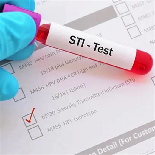 Swiftcare Diagnostic Cares for Your Health! STis can be silent but serious. Regular testing is the key to protection and peace of mind. • Get tested confidentially at Swiftcare Diagnostic • Early detection. Expert care. Be aware. Stay safe. Stay healthy. O #SwiftcareDiagnostic #STiAwareness #GetTested #SafeSex #HealthMatters #Belnformed #StayProtected #YourHealthOurPriority #freehomecollection #labtest #pathologylab #bloodtest #bloodtest