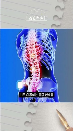 Spinal nerve stimulator implantation recommended for those with severe pain #shorts