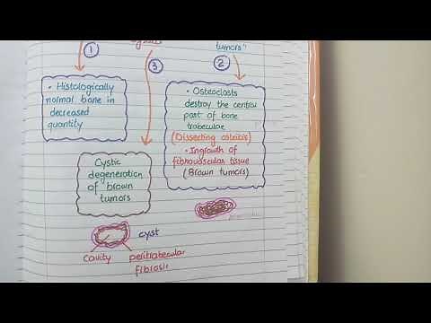 Brown Tumor and Osteitis Fibrosa Cystica | HYPERPARATHYROIDISM