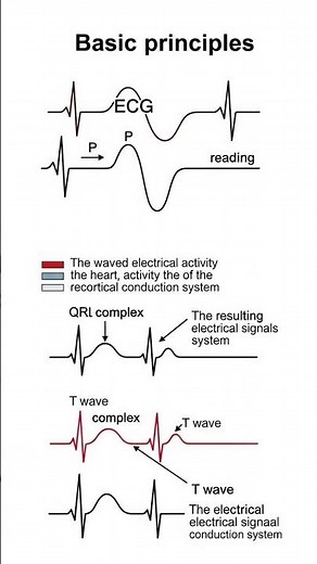 ECG- Basic Principles