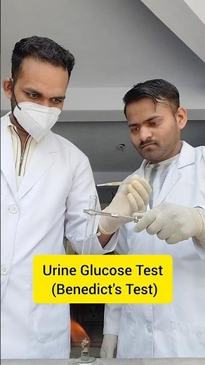 🧪 Urine Glucose Test (Benedict's Test) | Practical #Demonstration | BAMS Lab Practical #sattvalok