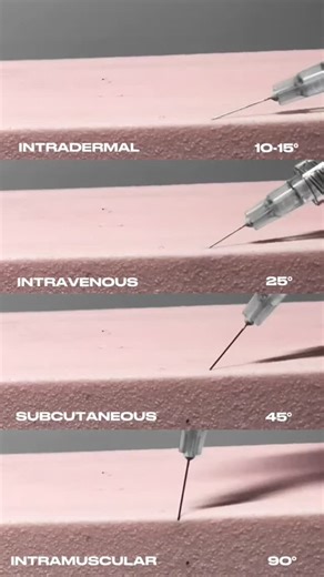 ❇️ Needle Angles Matter ملخص دقة زوايا الحقن🔰 ♦️ The Rule of Angle: 👈 الزاوية هي اللي بتحدد الـ Depth والـ Safety، وشكل توزيع المادة المحقونة (Product settlement). ـــــــــــــــــــــــــــــــــــــ ♦️ Common Technical Errors: 👈 الـ Too steep angle: بتخليك تفقد السيطرة على الـ Plane (مستوى الحقن) وممكن تروح Deep بزيادة. 👈 الـ Too flat angle: بتزيد من مخاطر الـ Superficial placement، وهذا ممكن يسبب تكتلات أو نتائج غير مرغوبة. ـــــــــــــــــــــــــــــــــــــ ♦️ Anatomy-Led Technique: 