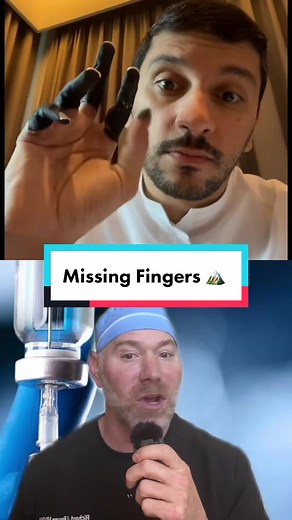 Save The Thumb: Frostbite & Hand Function