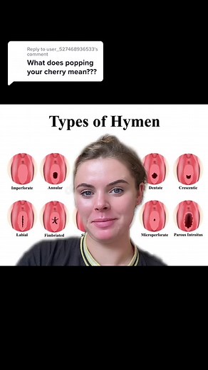 Replying to @user_527468936533 What does popping your cherry mean? 🍒Your cherry/the hymen can be torn or stretched as a result of many things, not necessarily through intercourse!🍒 #itsjustaphase #poppingyourcherry #hymen #wellness #educationtiktok #yourfirsttime #fyp #foryou