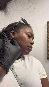 Experience masseter botox at naturalbodyspaandshop