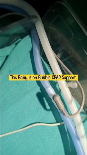 neonate baby#bubble CPAP # VENTILATOR# Pre term #NICU #ICU#HOSPITAL
