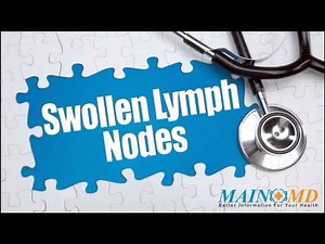 Swollen Lymph Nodes ¦ Treatment and Symptoms