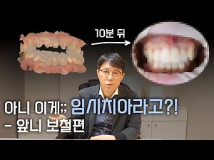 임시치아 - 앞니 보철편-