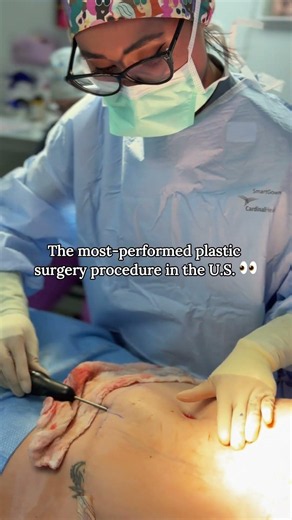 The #1 Procedure Performed In The U.S. 👀