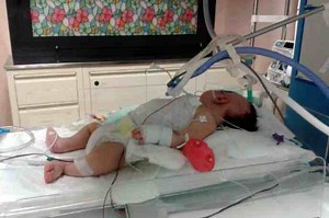 Brain monitoring of the newborn: what it is and why it is practised