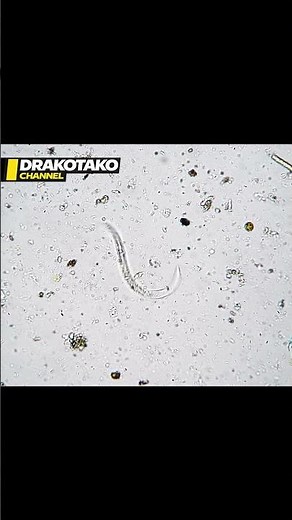 Nematodes: The microscopic worms hidden almost everywhere 🪱