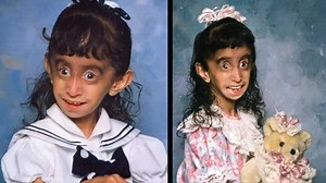 26K views · 199 reactions | “From a forgotten birthday to a social media sensation—Lizzie’s incredible journey!”  Once overlooked and misunderstood, Lizzie now has 100,000 followers who admire her strength and beauty. She’s turned her story into an inspiration! See her transformation in the comments below  | Stories Of The World | Facebook