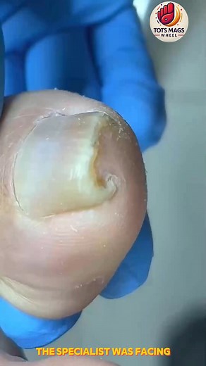 Senior toenail cleaning that supports all-day comfort 💖 #SeniorNailCare #FootCareRoutine #DailyWellness | Tots Mags Wheel