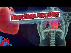 Kawashima procedure - Human Heart and Cardiology ❤️❤️❤️🔊✅