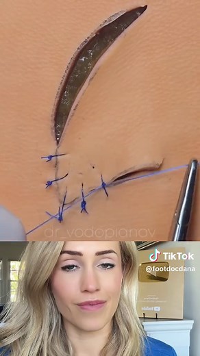 Medical Suturing Demonstration: Stitches Explained