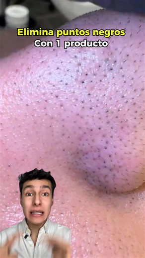 Carlos Raul Morales | Sígueme para más tips ❤️ Limpiador en Aceite + espuma en un solo paso 💗🤍 El Rose Vitamin Brightening Oil to Foam Cleanser de MAXCLINIC... | Instagram