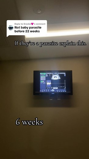 Understanding the Pro-Life Perspective on Pregnancy