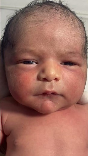 Cute Little Baby in NICU | Nursing Care ❤️