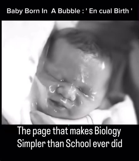 Bio Simplified on Instagram: "Baby Born in a Bubble — En Caul Birth An en caul birth occurs when a baby is delivered completely inside the amniotic sac — the thin, fluid-filled “bubble” that protects the baby during pregnancy. Normally, this sac breaks before or during labor (“water breaking”), but in an en caul birth it remains fully intact at delivery. Why It’s Special • Extremely rare, especially in vaginal births • The baby appears to be floating inside a clear bubble • Considered a symbol o